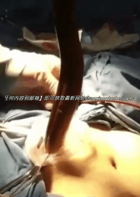 图片[4]-【特殊资源】当年火遍全网的黄鳝门事件，相信大家都看过了-山相欢迎您！